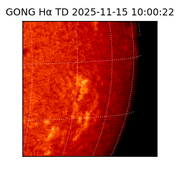 gong - 2025-11-15T10:00:22