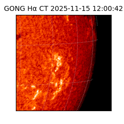 gong - 2025-11-15T12:00:42