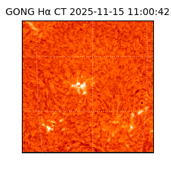 gong - 2025-11-15T11:00:42