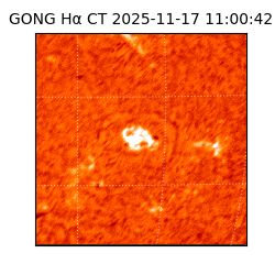 gong - 2025-11-17T11:00:42