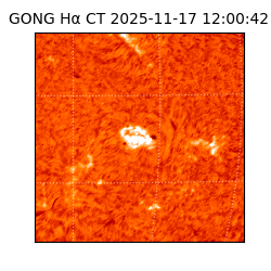 gong - 2025-11-17T12:00:42