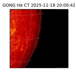 gong - 2025-11-18T20:00:42