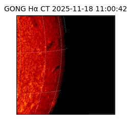 gong - 2025-11-18T11:00:42