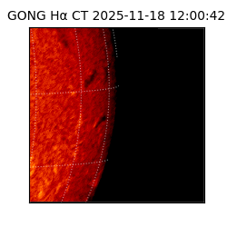 gong - 2025-11-18T12:00:42