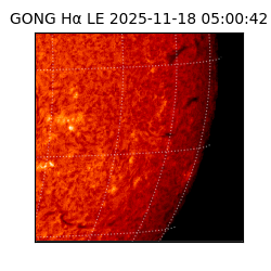 gong - 2025-11-18T05:00:42