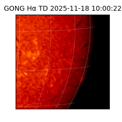 gong - 2025-11-18T10:00:22