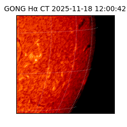 gong - 2025-11-18T12:00:42