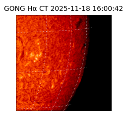 gong - 2025-11-18T16:00:42