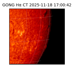 gong - 2025-11-18T17:00:42