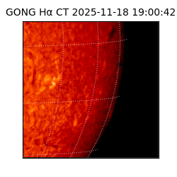 gong - 2025-11-18T19:00:42