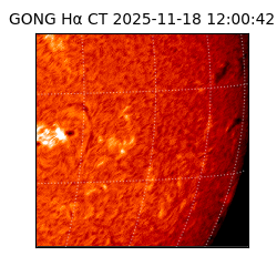 gong - 2025-11-18T12:00:42