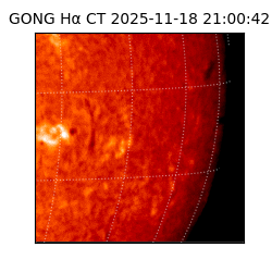 gong - 2025-11-18T21:00:42
