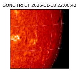 gong - 2025-11-18T22:00:42