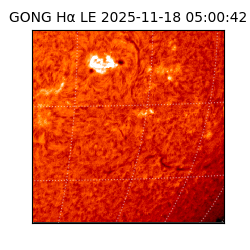 gong - 2025-11-18T05:00:42