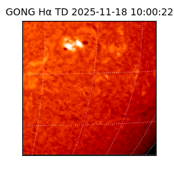 gong - 2025-11-18T10:00:22