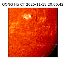 gong - 2025-11-18T20:00:42