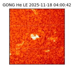 gong - 2025-11-18T04:00:42