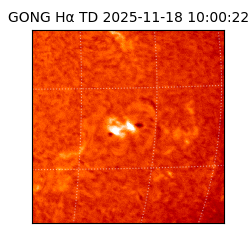 gong - 2025-11-18T10:00:22