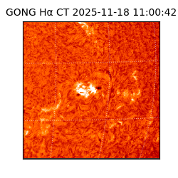gong - 2025-11-18T11:00:42