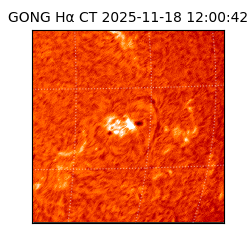 gong - 2025-11-18T12:00:42