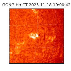 gong - 2025-11-18T19:00:42