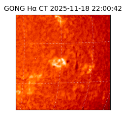gong - 2025-11-18T22:00:42
