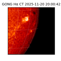 gong - 2025-11-20T20:00:42