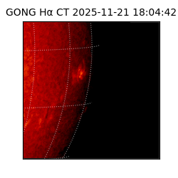 gong - 2025-11-21T18:04:42