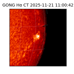 gong - 2025-11-21T11:00:42