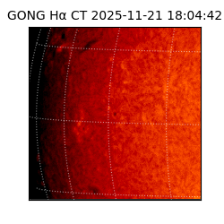 gong - 2025-11-21T18:04:42
