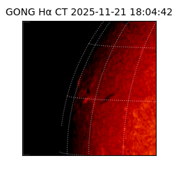 gong - 2025-11-21T18:04:42