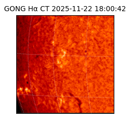gong - 2025-11-22T18:00:42