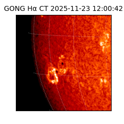 gong - 2025-11-23T12:00:42