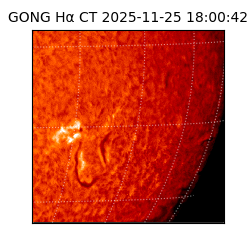 gong - 2025-11-25T18:00:42