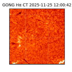 gong - 2025-11-25T12:00:42