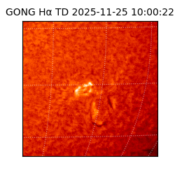 gong - 2025-11-25T10:00:22