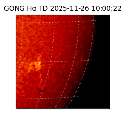 gong - 2025-11-26T10:00:22