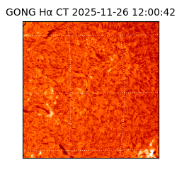 gong - 2025-11-26T12:00:42