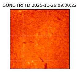 gong - 2025-11-26T09:00:22