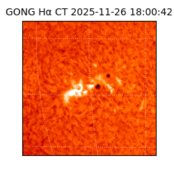 gong - 2025-11-26T18:00:42