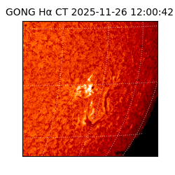 gong - 2025-11-26T12:00:42