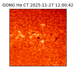 gong - 2025-11-27T12:00:42