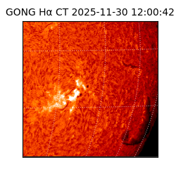 gong - 2025-11-30T12:00:42