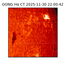 gong - 2025-11-30T22:00:42