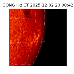 gong - 2025-12-02T20:00:42