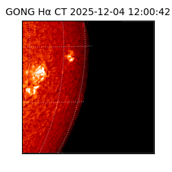 gong - 2025-12-04T12:00:42