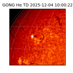 gong - 2025-12-04T10:00:22