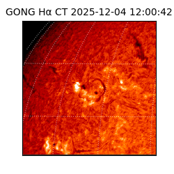 gong - 2025-12-04T12:00:42