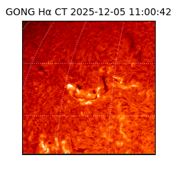 gong - 2025-12-05T11:00:42