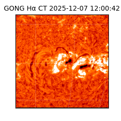 gong - 2025-12-07T12:00:42